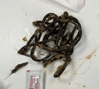 Illustration de l'article : Constatant que leur chat est malade, des propriétaires se rendent chez le vétérinaire et découvrent ce qui se trouve dans son estomac