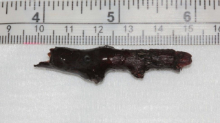 Illustration de l'article : Une chienne joue dans une haie et en ressort avec un bâton de 5 cm enfoncé dans l'œil