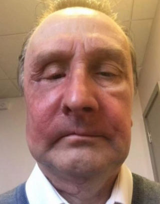 Illustration de l'article : Grâce à son flair, une chienne sauve son maître d’un cancer non diagnostiqué